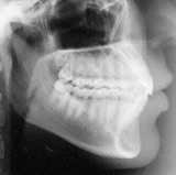 Radiologia Odontológica em Vila Velha